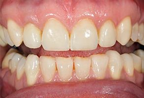 dental images in Rochester