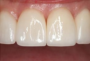 dental images 55902
